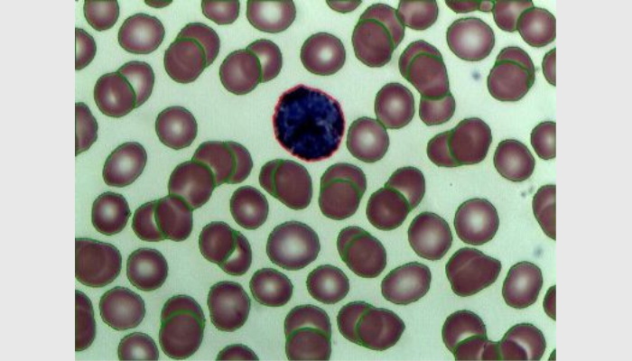 MIA-V生物顯微圖像分析儀系統,細胞計數分析儀